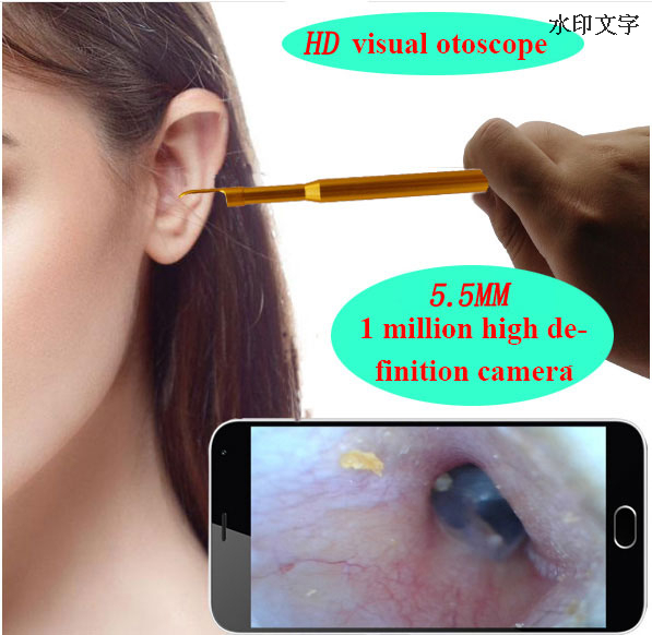 IP67 Waterproof PS-ER001 0.3MP Ear Cleaning Endoscope 3 in1 USB HD Visual Ear Spoon 5.5mm Mini Camera Android PC Ear pick digital Otoscope Borescope Tool