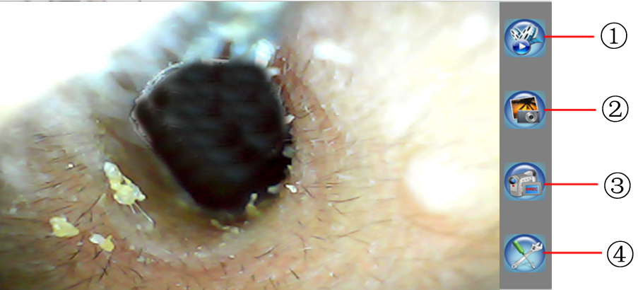 Ear Endoscope01
