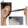 PS-ER003 Black Ear Endoscope
